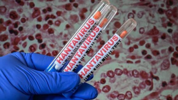 Venezuela registra tres muertes por hantavirus en lo que va del año