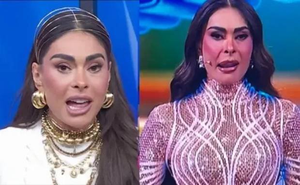 Galilea Montijo revela los detalles de su procedimiento estético fallido