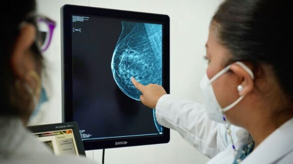 Desarrollan Inteligencia Artificial que agiliza detección de cáncer