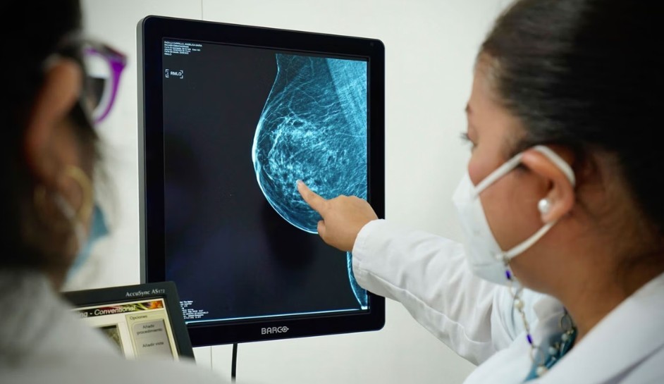 Desarrollan Inteligencia Artificial que agiliza detección de cáncer