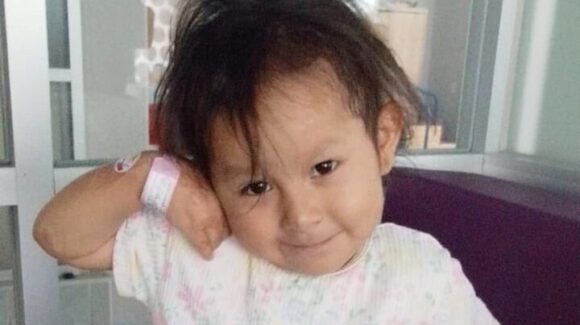 Operan con éxito a Jazlyn, niña sobreviviente de explosión de pipa de gas en Iztapalapa