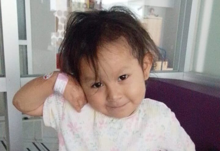 Operan con éxito a Jazlyn, niña sobreviviente de explosión de pipa de gas en Iztapalapa