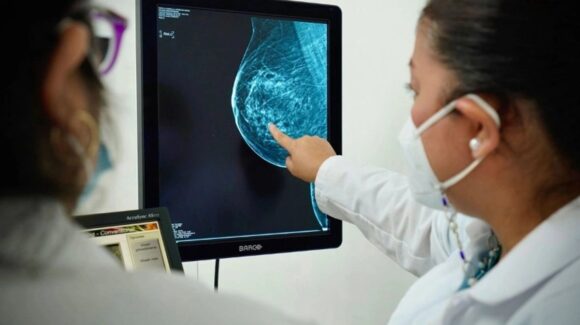 La Ciudad de México supera el promedio nacional de muertes por cáncer de mama, según el Inegi
