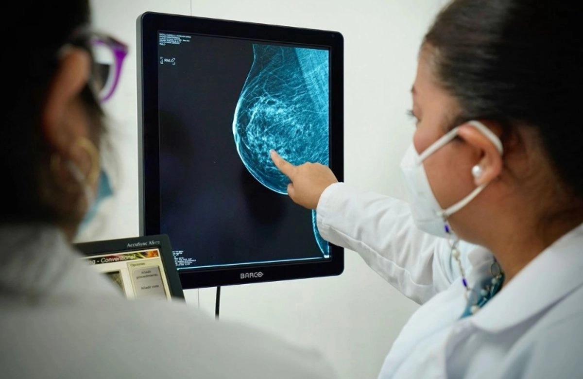 La Ciudad de México supera el promedio nacional de muertes por cáncer de mama, según el Inegi